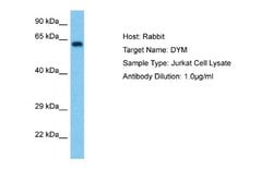 DYM Antibody, Novus Biologicals 100 &mu;L; Unconjugated:Antibodies, Polyclonal